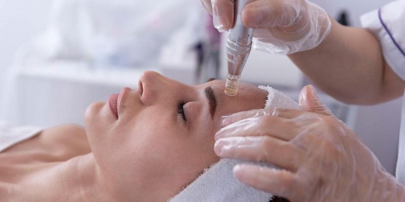 Microneedling Salmon DNA